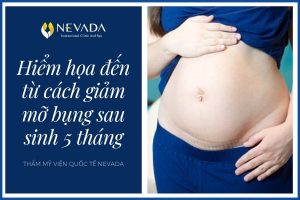 Cách giảm mỡ bụng sau sinh 5 tháng – Con dao bén lưỡi khiến sức khỏe các chị em bỉm sữa lao đao